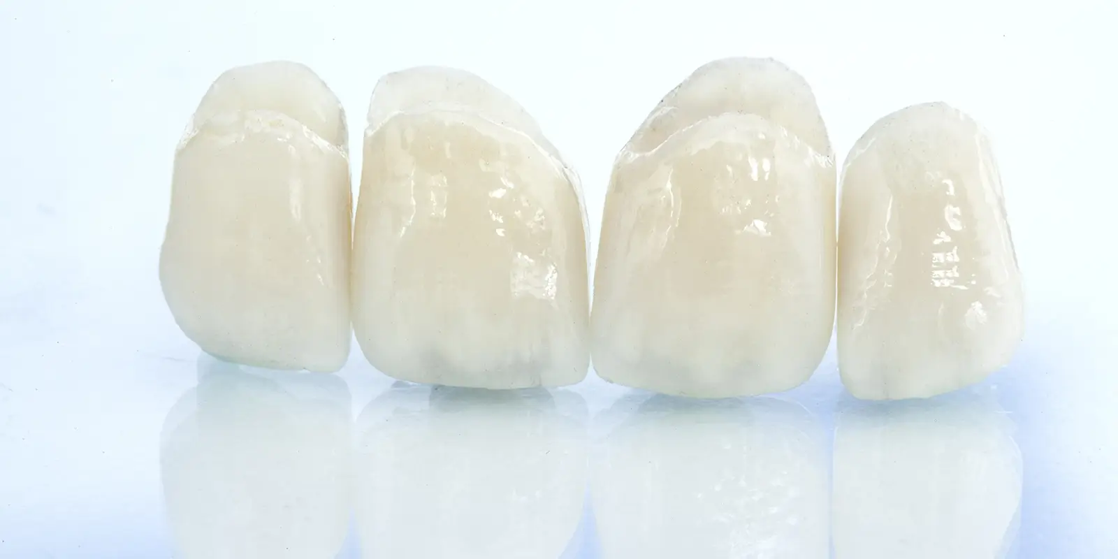 セラミックが選ばれる理由銀歯が引き起こす3つの問題