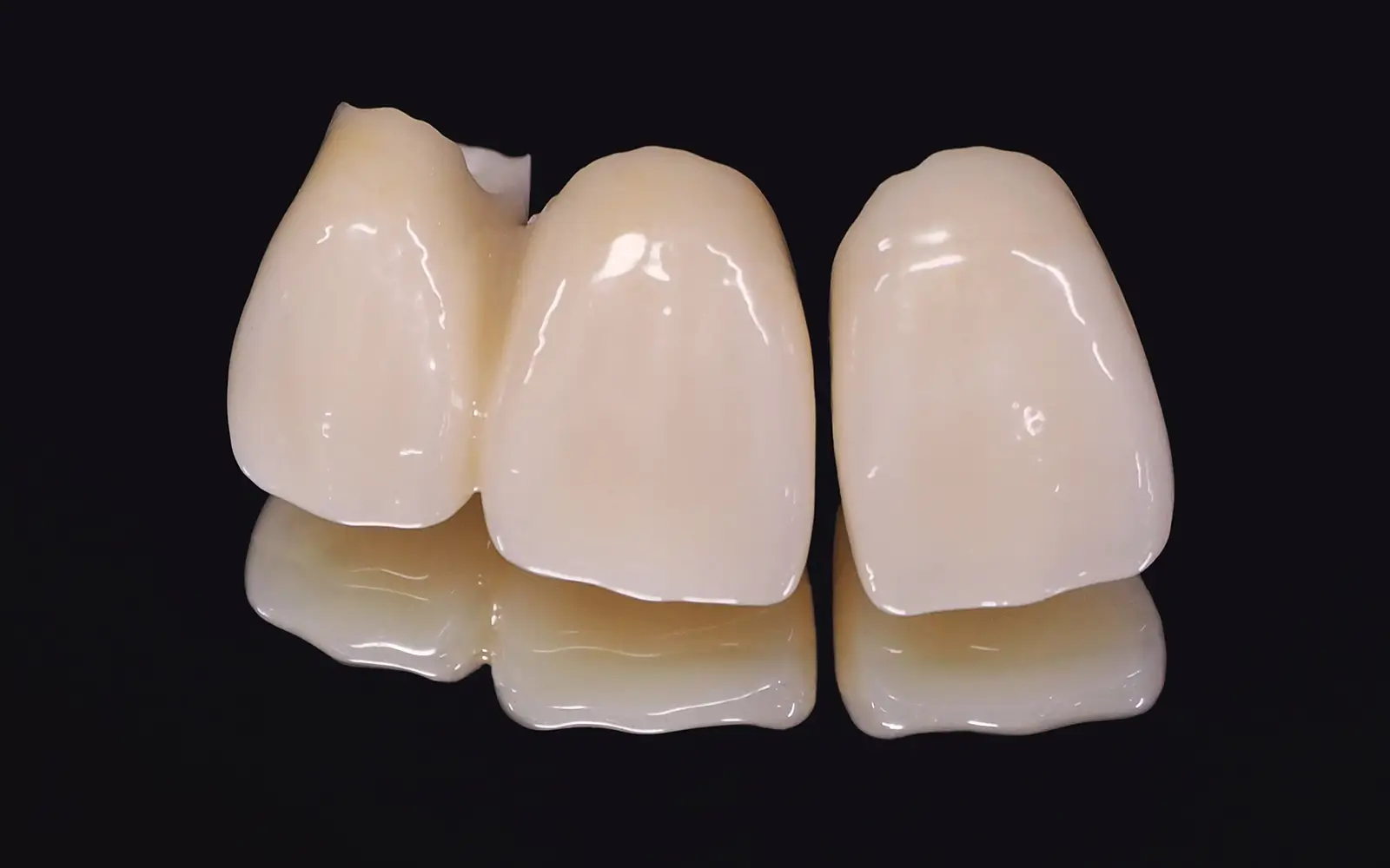 ジルコニア+陶材焼き付け：強度と透明感を両立する前歯向けの選択肢