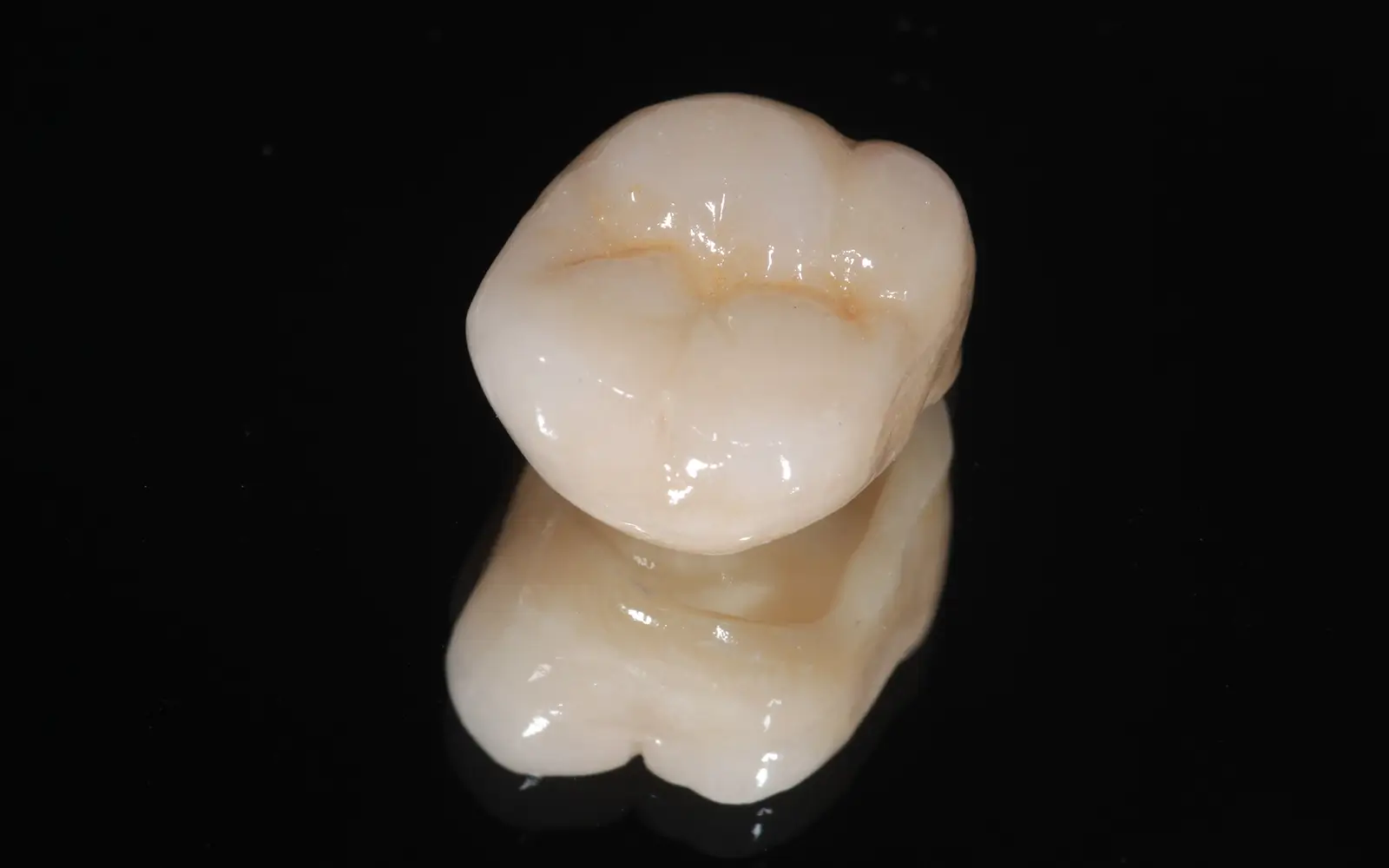 CAD/CAM冠：保険適用で白い被せ物を選べる選択肢