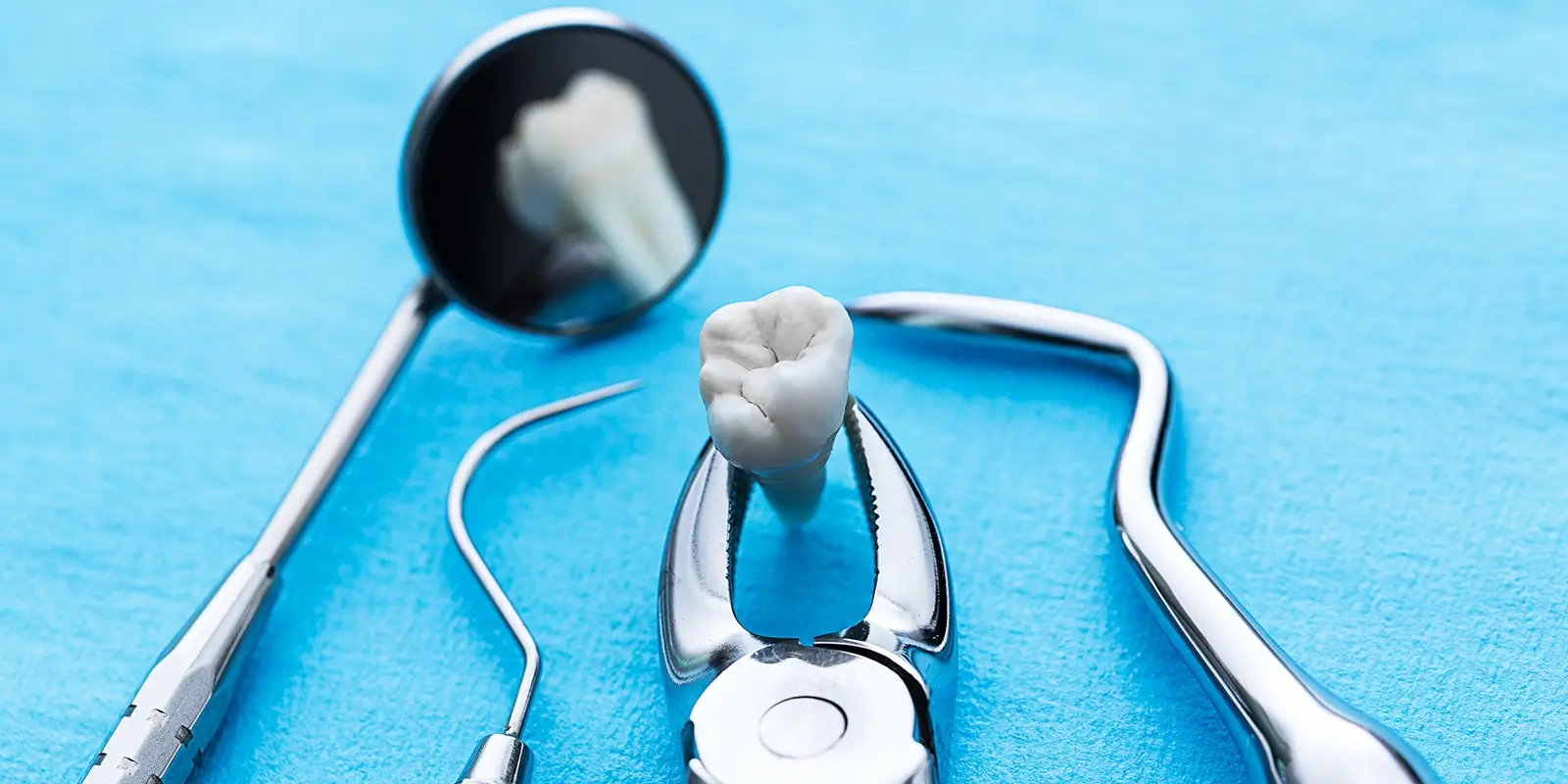 親知らずが痛みや腫れを繰り返す理由と、放置するリスク